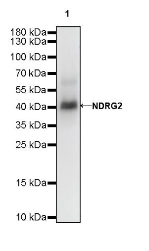 NDRG2 Recombinant Rabbit mAb (S-618-76)