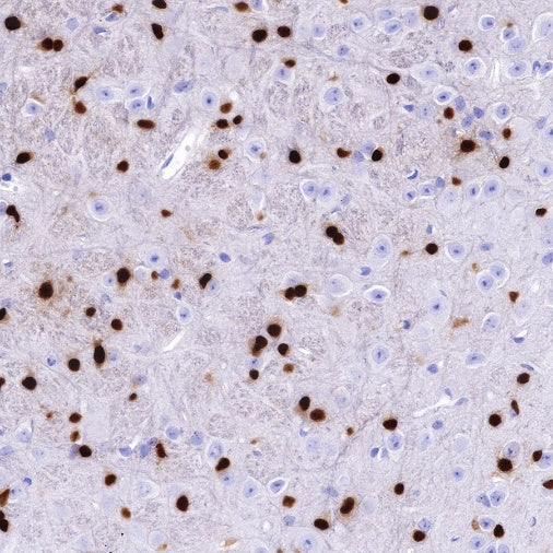 S-RMab® SOX10 Recombinant Rabbit mAb (SDT-R233)