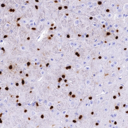 S-RMab® SOX10 Recombinant Rabbit mAb (SDT-R233)