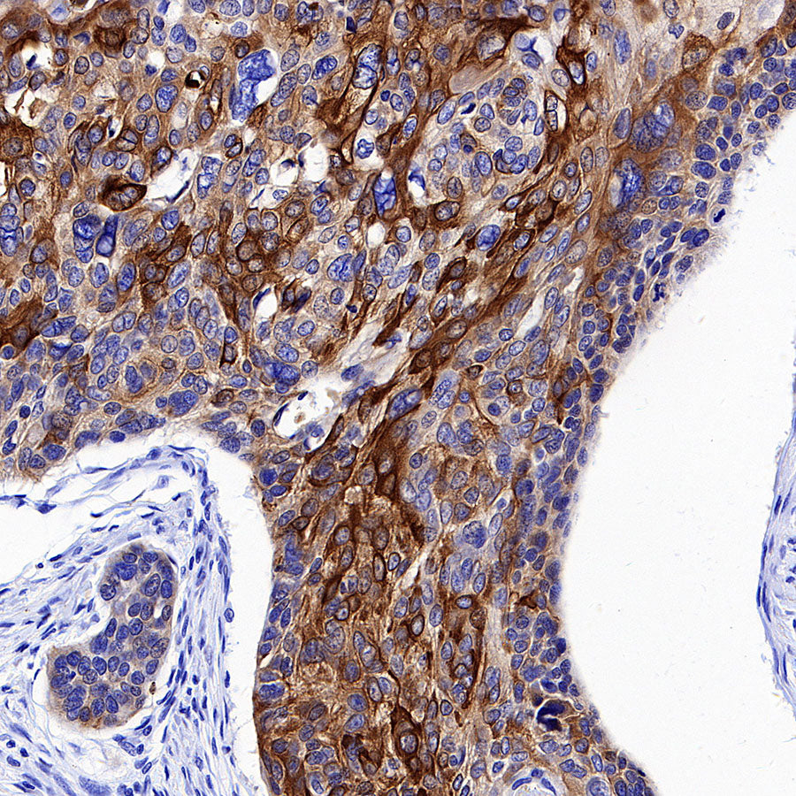 Cytokeratin 1 Recombinant Rabbit mAb (SDT-3225-22)