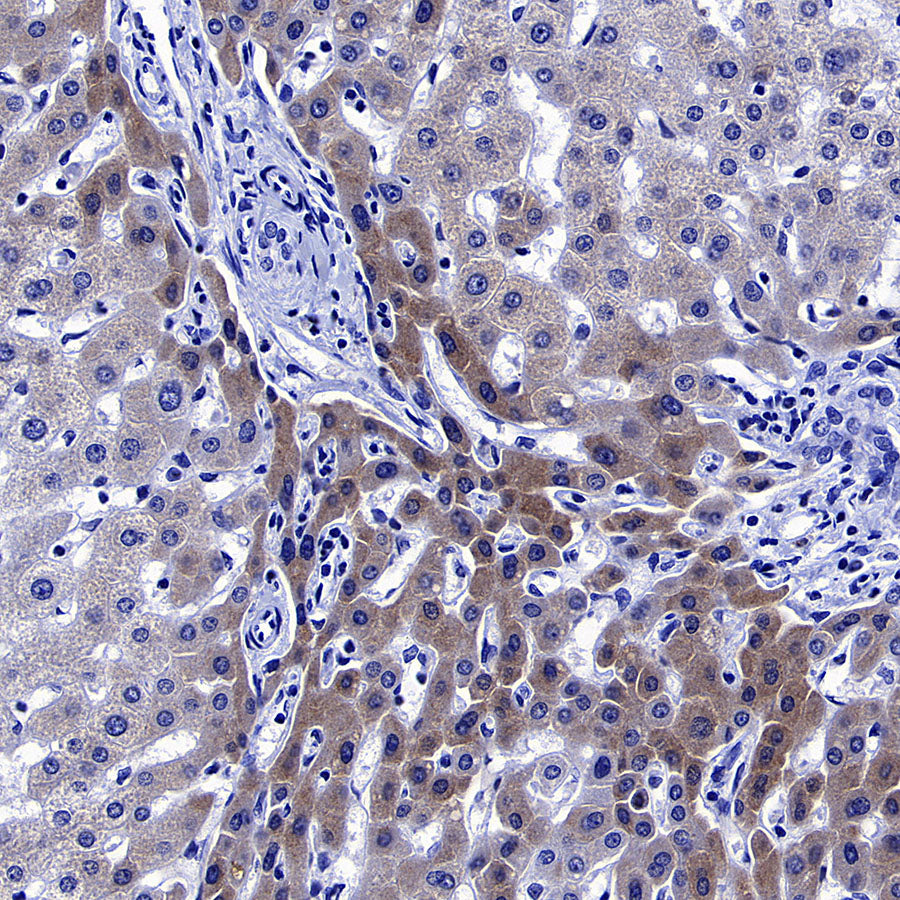 Factor XII (FXII) Recombinant Rabbit mAb (S-4487-31)