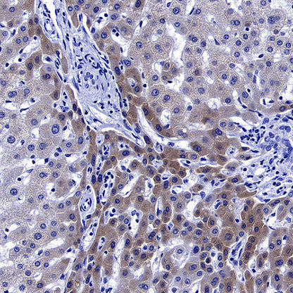 Factor XII (FXII) Recombinant Rabbit mAb (S-4487-31)