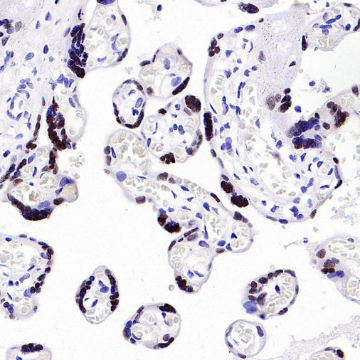 AP2α Recombinant Rabbit mAb (S-2376-7)