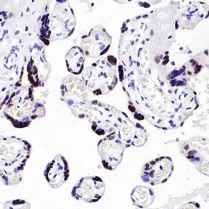 AP2α Recombinant Rabbit mAb (S-2376-7)