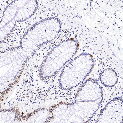 SP100 Rabbit Polyclonal Antibody
