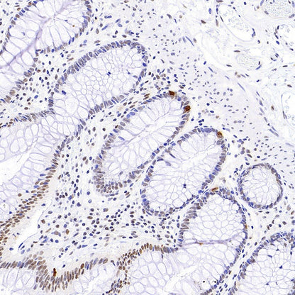 SP100 Rabbit Polyclonal Antibody