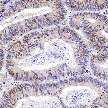 CDK2 Recombinant Rabbit mAb (S-1308-13)