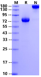 Biotinylated IL-15R alpha/CD215 Fc&Avi Tag Protein, Human
