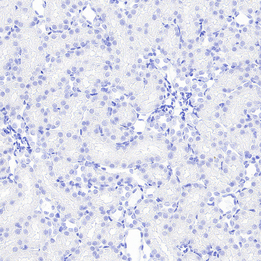 Myoglobin Recombinant Rabbit mAb (S-6197)