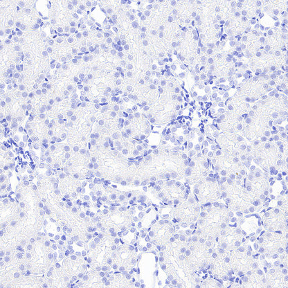 Myoglobin Recombinant Rabbit mAb (S-6197)