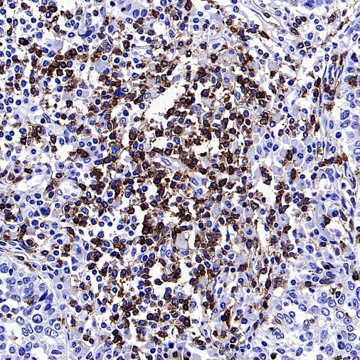 CD5 Recombinant Rabbit mAb (SDT-2857-16)