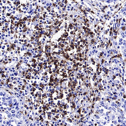 CD5 Recombinant Rabbit mAb (SDT-2857-16)
