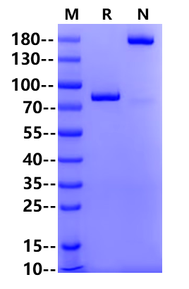 Coagulation factor XI/FXI His Tag Protein, Human
