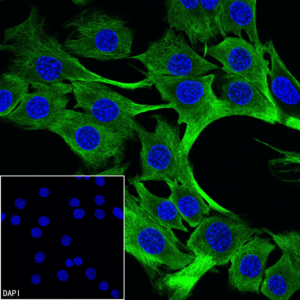 Beta III Tubulin Recombinant Rabbit mAb (S-5529)
