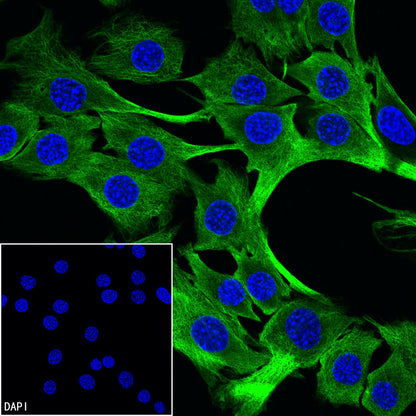 Beta III Tubulin Recombinant Rabbit mAb (S-5529)
