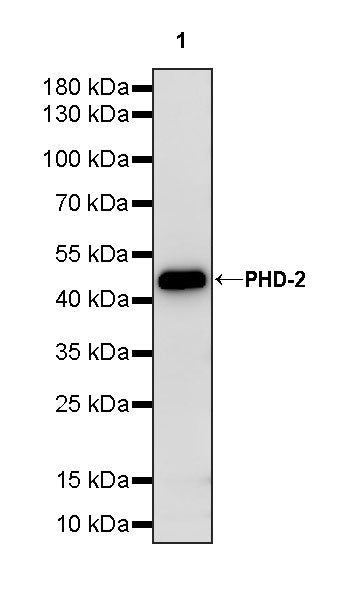 PHD-2 Recombinant Rabbit mAb (S-4111-17)