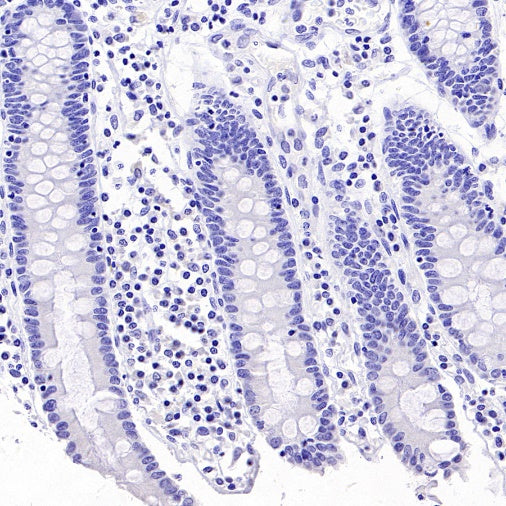 SS18-SSX Recombinant Rabbit mAb (SDT-4202)