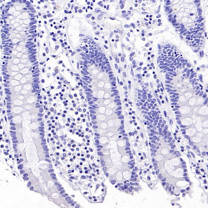SS18-SSX Recombinant Rabbit mAb (SDT-4202)