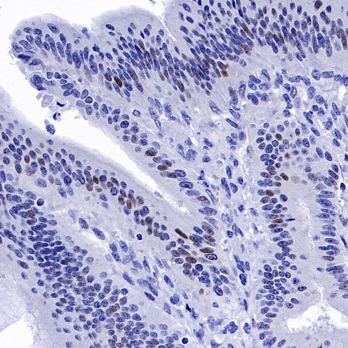p21 Waf1/Cip1 Mouse mAb (469-2)