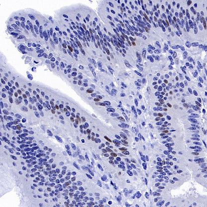 p21 Waf1/Cip1 Mouse mAb (469-2)