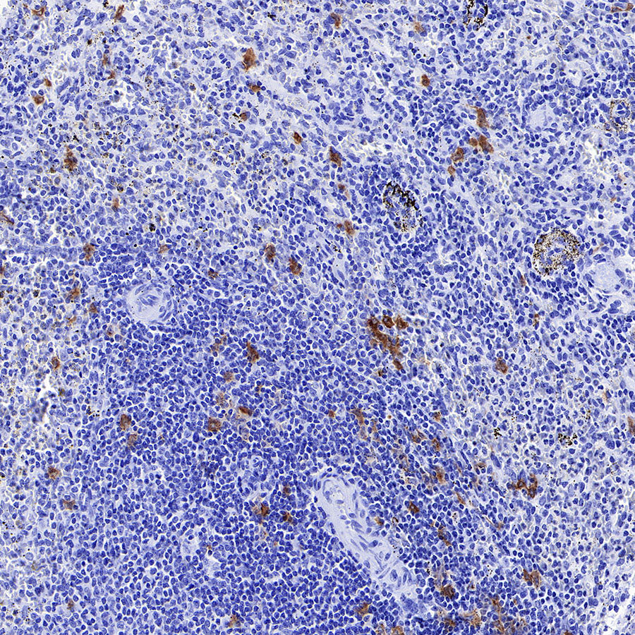 CLEC9A Recombinant Rabbit mAb (S-1904-154)