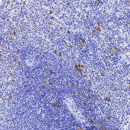 CLEC9A Recombinant Rabbit mAb (S-1904-154)