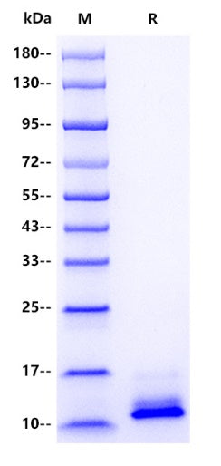 Rat C5a Protein, His tag