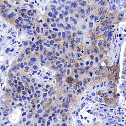 IMP-3 Recombinant Rabbit mAb (S-439-10)