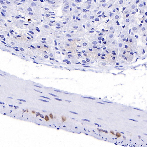 PHOX2B Recombinant Rabbit mAb (SDT-1142-21)
