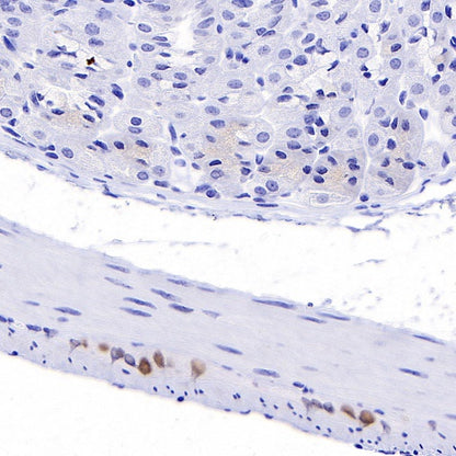 PHOX2B Recombinant Rabbit mAb (SDT-1142-21)