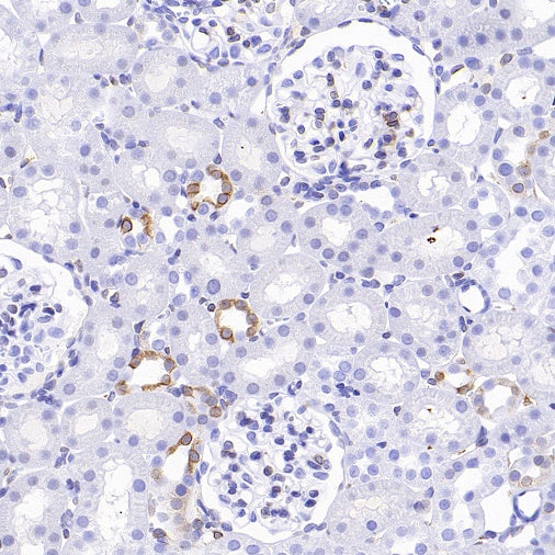 COX1/Cyclooxygenase 1 Recombinant Rabbit mAb (S-1478-48)