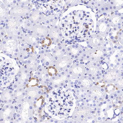 COX1/Cyclooxygenase 1 Recombinant Rabbit mAb (S-1478-48)
