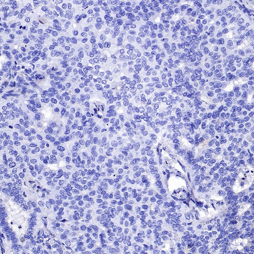 Brachyury Recombinant Rabbit mAb (SDT-1926-107)