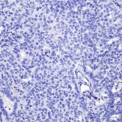 Brachyury Recombinant Rabbit mAb (SDT-1926-107)