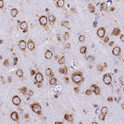 BiP Rabbit Polyclonal Antibody