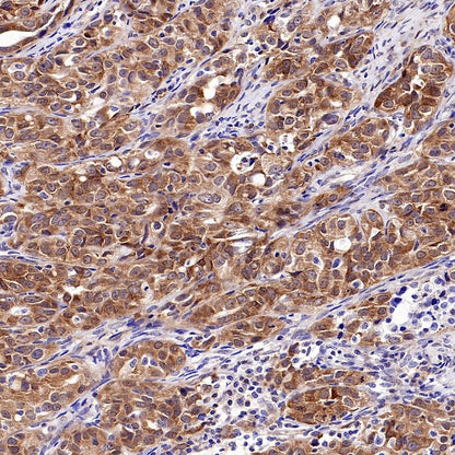 Argonaute 2 Recombinant Rabbit mAb (S-2620-13)