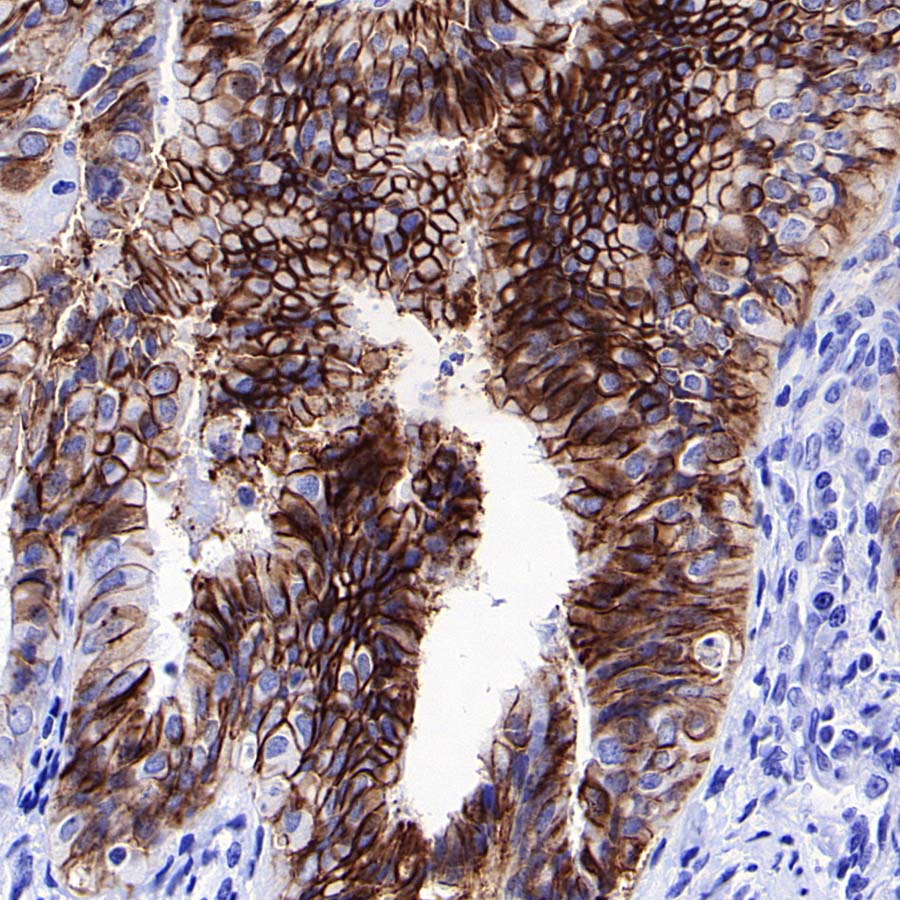 ALCAM Recombinant Rabbit mAb (S-4080-40)