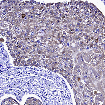 Cytokeratin 1 Recombinant Rabbit mAb (SDT-3225-22)
