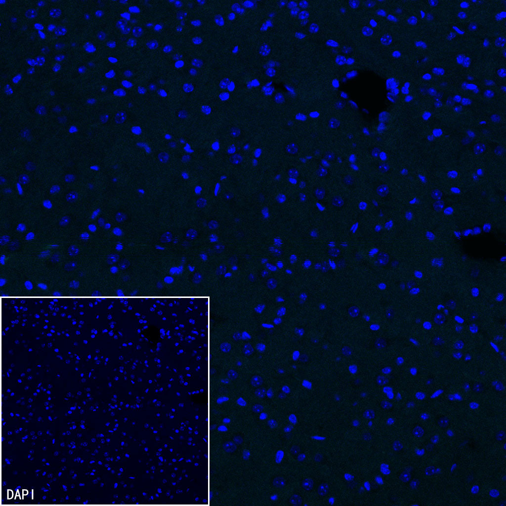 Olfactory Marker/OMP Recombinant Rabbit mAb (S-3513-32)