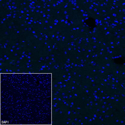 Olfactory Marker/OMP Recombinant Rabbit mAb (S-3513-32)