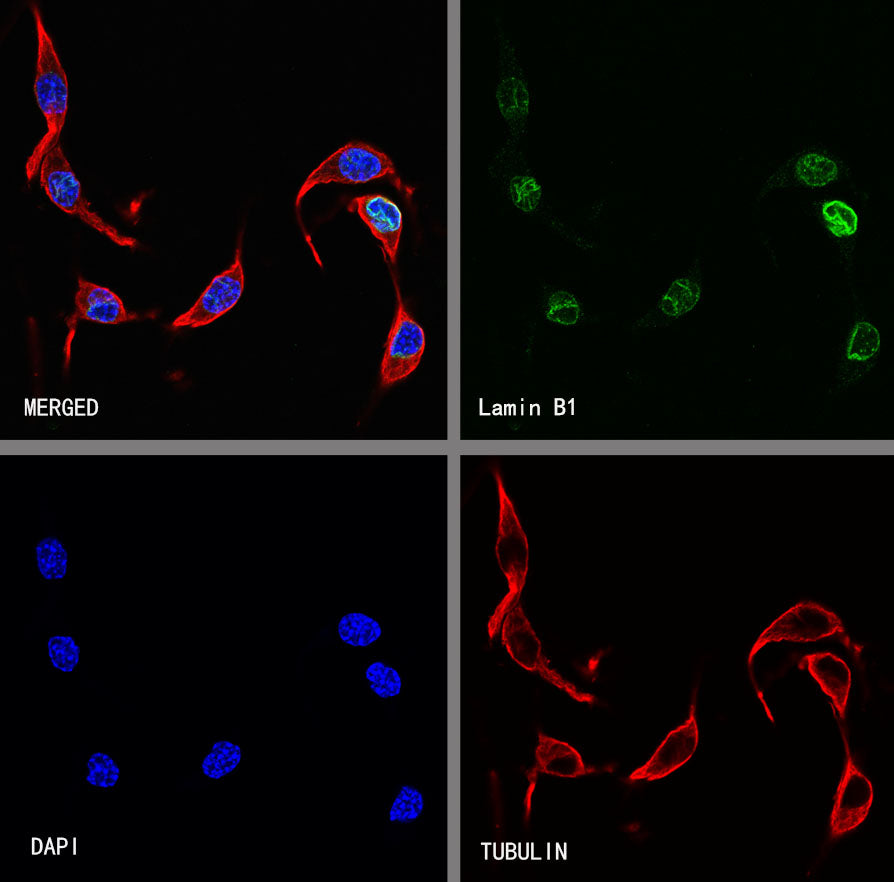 Lamin B1 Recombinant Rabbit mAb (S-5361)