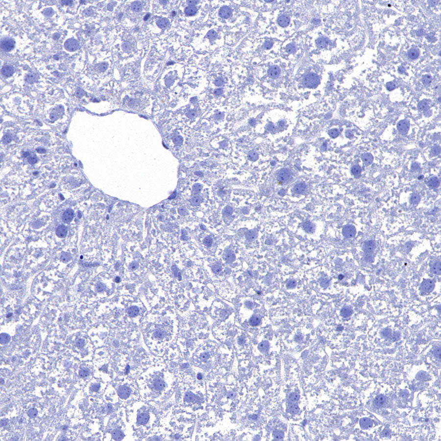SLC7A5 Recombinant Rabbit mAb (S-4496-55)