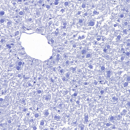 SLC7A5 Recombinant Rabbit mAb (S-4496-55)