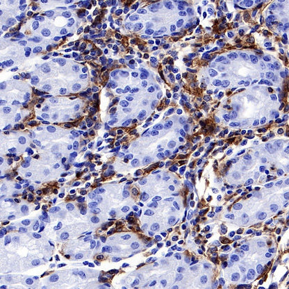 LAIR1 Recombinant Rabbit mAb (S-285-2)