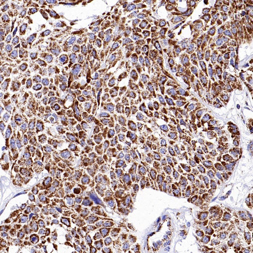 HADHA Recombinant Rabbit mAb (S-2345-8)