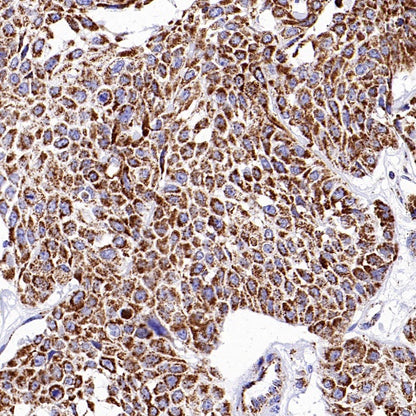 HADHA Recombinant Rabbit mAb (S-2345-8)