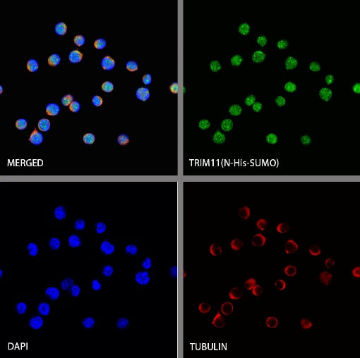 TRIM11 Recombinant Rabbit mAb (S-2960-11)