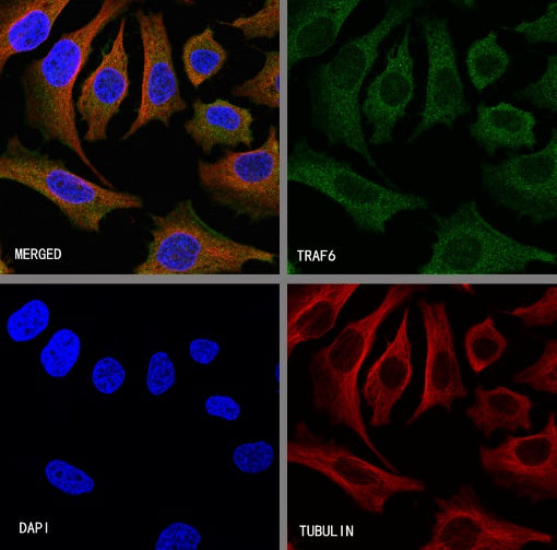 TRAF6 Recombinant Rabbit mAb (S-1087-44)