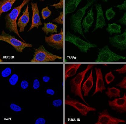 TRAF6 Recombinant Rabbit mAb (S-1087-44)