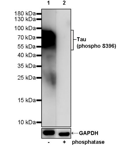 Tau (phospho S396) Recombinant Rabbit mAb (S-1016-38)